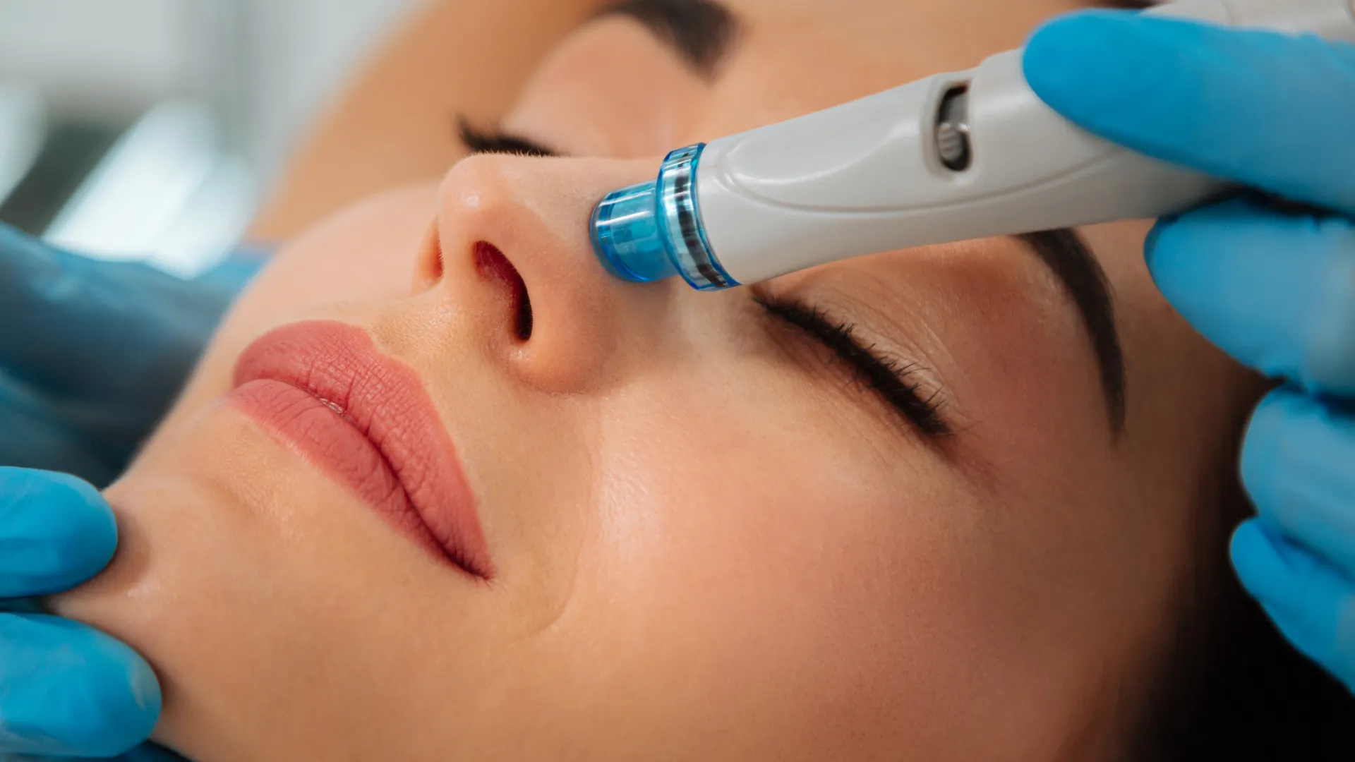 Hydrafacial